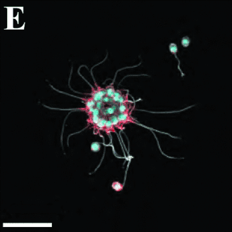 Kleine Kolonie von B. monosierra (Durchmesser 19 µm). Balken: 20 µm.