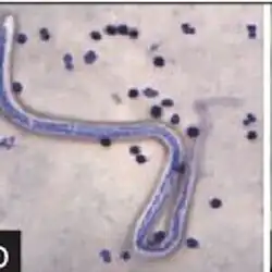 Brugia timori unterm Mikroskop