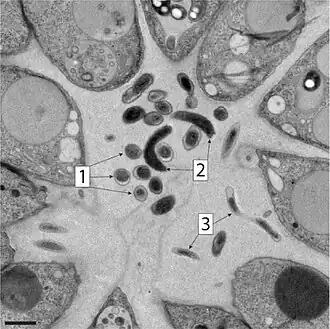 Verschiedene Morphologien (1–3) der bakteriellen Symbionten in B. monosierra (TEM-Aufnahme, Balken: 1 µm).