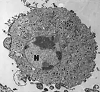 FV3-infizierte Zelle, die Virionen sind über das Zytoplasma verteilt