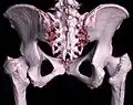 3D-Rekonstruktion (Volumenrendering) des Beckens aus einem CT-Scan