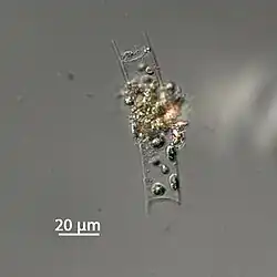 H. hauckii in Formalin, vom Atlantik, November 2015, Expedition der Polarstern.