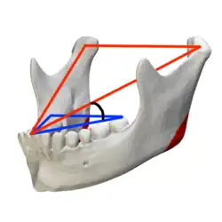 Balkwill-Winkel schwarz Bonwill-Dreieck rot Kauebene blau