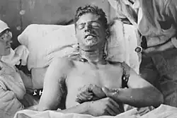 Kanadischer Soldat mit Verletzungen durch Senfgas