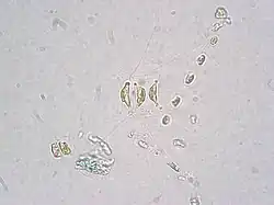 LM-Aufnahme von C. wighamii Brightwell