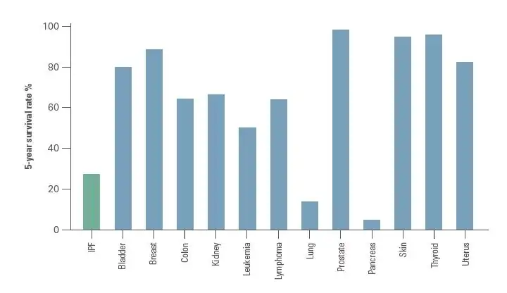 Vergleich der 5-Jahres-Überlebensrate zwischen IPF und gängigen Malignomen. Adaptiert nach Bjoraker et al. 1998.[45]