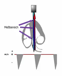 Schema der Messung mittels CW-Doppler an der Aorta
