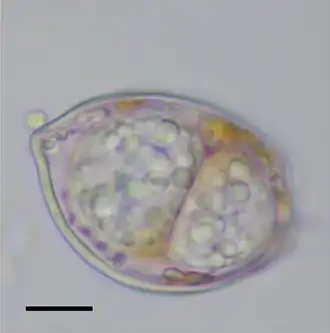 Doppelinfektion zweier „später“ Tro­phon­ten von Dinovorax pyriformis (Perkinsozoa) in einer Zelle des Dinoflagellaten Prorocentrum micans. Balken: 10&nbsp;μm.