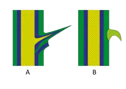 Biologischer Unterschied von Dorn (A) und Stachel (B)