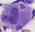 Neutrophiler Granulozyt in einer Megakaryozyte