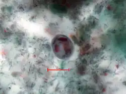 Zweikernige Zyste, E. histolytica