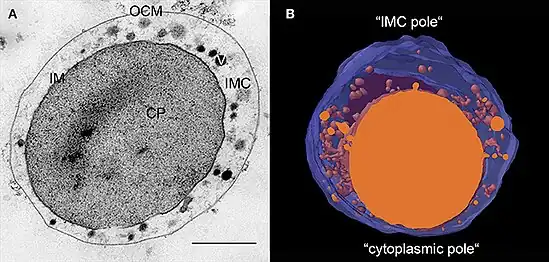 Ultrastruktur von I.&nbsp;hospitalis (Bild mit Anmerkungen)