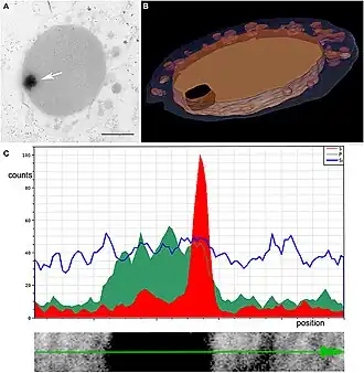 Energiedispersive Röntgen­spektro­skopie (EDX) von dunkel kontrastierten Einschlüssen im Zytoplasma.