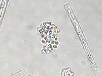 Gomphosphaeria sp., eine Blaualge, wie sie laut Kann unter anderem auch im Lunzer See vorkommt, aber (wegen Merkmalsarmut) kaum näher zu bestimmen war.