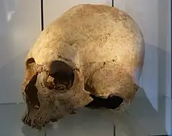 Künstlich deformierter Schädel ( 500.n.&nbsp;Chr. ) eines Hunnen/Ostgermanen, aus einem Grab in Regensburg-Irlmauth