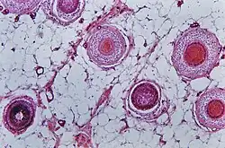 Der histologische Schrägschnitt der menschlichen Kopfhaut zeigt in unterschiedlicher Höhe angeschnittene Haarfollikel (Hämatoxylin-Eosin-Färbung)