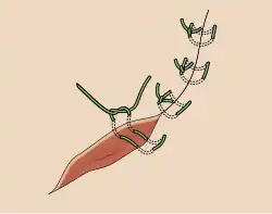 Horizontale Matratzennaht