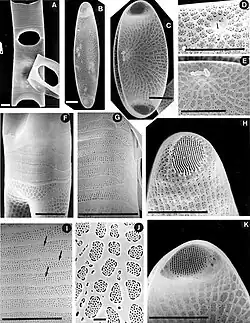 Eucampia antarctica (?⇒ Neomoelleria antarctica)