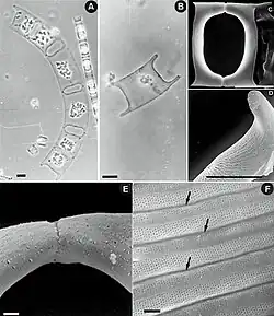 Eucampia zodiacus f. cylindrocornis