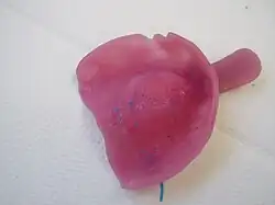 Individueller Löffel für einen zahnlosen Oberkiefer