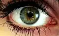 Zweifarbige Iris, (sog. „zentrale Heterochromie“): Äußere Iris grün, Ring um die Pupille gelblich-braun.