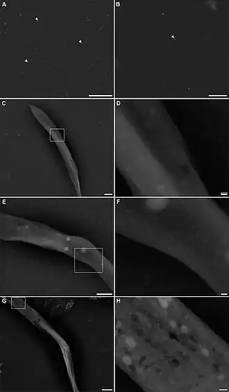 Ultrastrukturelle Analyse von S.&nbsp;culicis, markiert mit einem Anti-ScIT-Antikörper (anti-ScIT antibody).