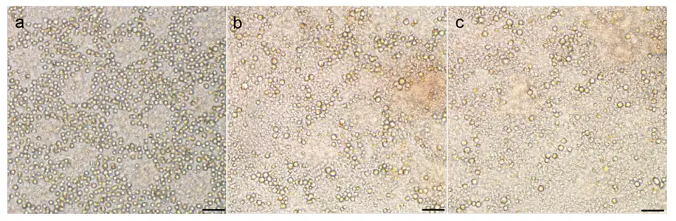 Zellen im Ruhestadium (RSCs) von A.&nbsp;anophagefferens Stamm&nbsp;CCMP1984 nach längerer Lagerung (von l. nach r.: 1, 2 und 3 Monate); Balken 10&nbsp;µm.[1]