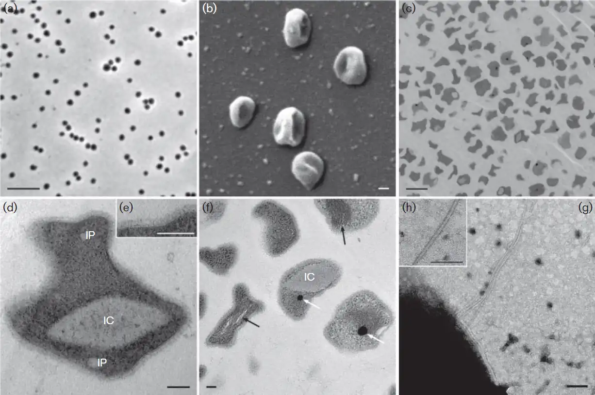 (a) Phasenkontrastbild; Balken: 5&nbsp;µm. (b) REM-Aufnahme mehrerer Zellen mit unregelmäßig-kokkoider Form; Balken: 100&nbsp;nm. (c–f) TEM-Aufnahmen von Ultradünnschnitten chemisch fixierter Zellen von EN76ᵀ: 00(c) Übersichtsaufnahme mit unregelmäßiger Zellform; Balken: 1&nbsp;µm. 00(d,e) Vergrößerte Zelle mit intrazellulären Merkmalen, 00(d,e) darunter deutlich erkennbar ein potentielles intrazelluläres Kompartiment (IC) und Einlagerungen (IP) 00(d,e) Das Inset (e) zeigt Zellmembran, Pseudoperiplasma & S-Layer mit stärkerer Vergrößerung; Balken: 100&nbsp;nm. 00(f) Potentielles IC, hervorgehoben: tubulusartige Strukturen (weiße Pfeile) & elektronendichte Partikel; Balken: 100&nbsp;nm. (g,h) TEM-Aufnahmen einer Zelle mit Archaellum; das Inset (h) zeigt das vergrößerte Archaellum; Balken: 100&nbsp;nm. Zu den Begrifflichkeiten der Zellanatomie siehe Ignicoccus §Membransystem.