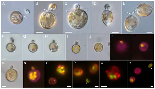 P. pervagatum Stamm LP-D10 (A-P,R) bzw. Stamm PM-01 (Q). Nahrungsaufnahme per Pedunkel in Licht- (A-J,M) oder Epifluoreszenzmikroskopie (K,L,N-R).