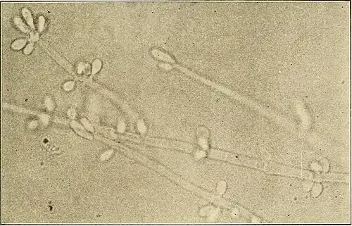 Sporotrichum schenckii