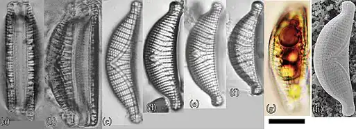 E. sorex: (a–g) LM- und (h) REM-Aufnahmen. Balken: 10 μm.