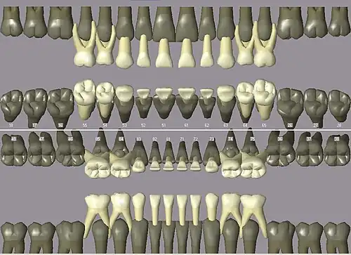 Milchgebiss mit FDI-Zahnschema