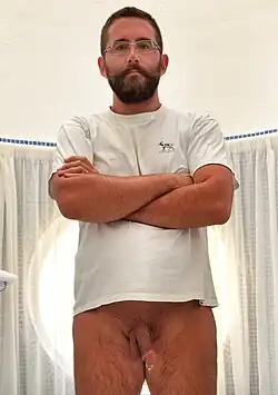 Seit der ersten Dekade des 21. Jahrhunderts werden Intimpiercings zunehmend beliebter:[12][13] Frau mit vertikalem Klitorisvorhautpiercing (links), Mann mit einem Prince Albert Piercing (rechts)