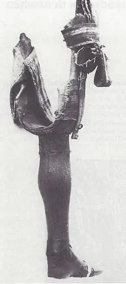 Oberschenkelprothese von Friedrich&nbsp;II. (Hessen-Homburg)