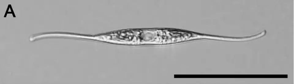 LM-Ansicht von N. reversa, Stamm KT30. Balken: 50 μm.