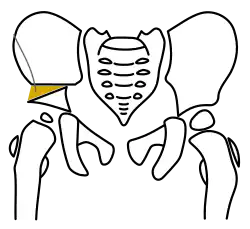 Schritt 4 – Fixation mit Kirschner-Drähten, Gewindestäben oder Zugschrauben