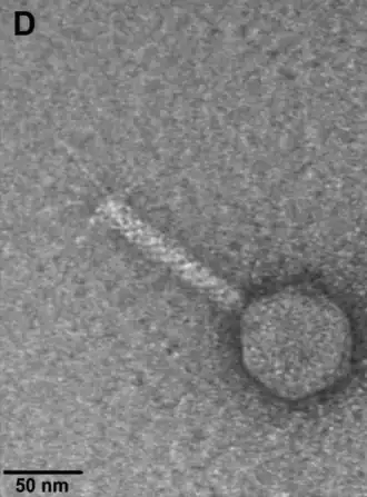 EM-Nahaufnahme eines Partikels von Escherichia-Phage vB_EcoM-VpaE1 (Felixounavirus VpaE1) mit Schwanzfibern.[8]