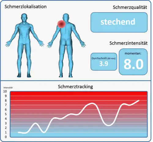 Exemplarische Vision eines Schmerzmonitoring-Screens. Visionär sollte ein Schmerzmonitoringsystem in der Lage sein, dem Kliniker alle relevanten Informationen (Lokalisation, Qualität, Intensität, Verlauf) über den aktuellen Schmerz des Patienten in effektiver Darstellung zu liefern.
