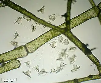 Vorticella campanula (Peritrichia)