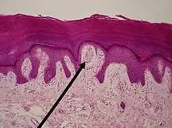 Ein Meissner-Körperchen (Spitze des schwarzen Zeigers) im Lichtmikroskop. Die Lokalisation im stratum papillare des Coriums ist gut zu erkennen.