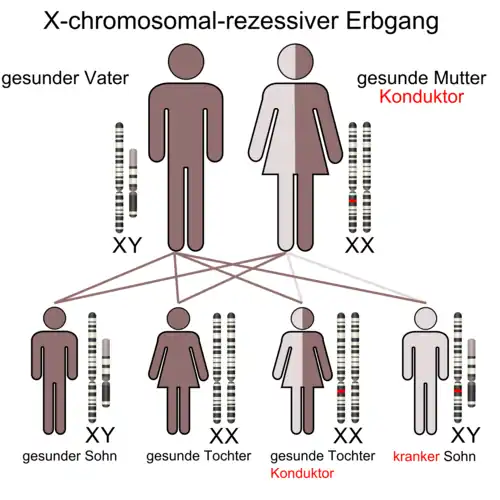X-chromosomal-rezessiver Erbgang (Mutter ist Konduktor)
