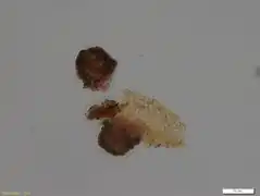 Diplochlamys gruberi