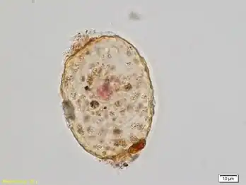 Amphitrema stenostoma