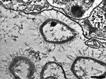 „Sputnik&nbsp;3“-Virophagen, produziert in einer VF von Moumouvirus (Gruppe-B-Mimiviren). Balken 200&nbsp;nm.[5]